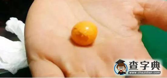 福建漁民撈海螺發(fā)現(xiàn)稀有珍珠6